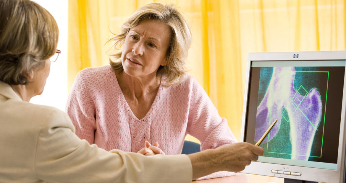 Cloruro de magnesio Mineral Milagroso y la osteoporosis