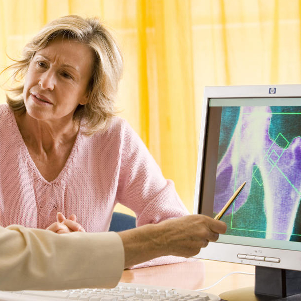 Cloruro de magnesio Mineral Milagroso y los beneficios para la osteoporosis